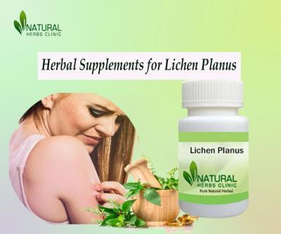 Herbal Products and Supplements for Lichen Planus Natural Recovery - Img 1
