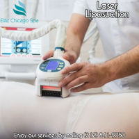 Laser Liposuction deals