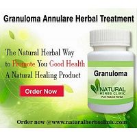 Natural Remedies for Granuloma Annulare Herbal Treatment