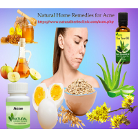 Get Rid Of Acne with Natural Home Remedies