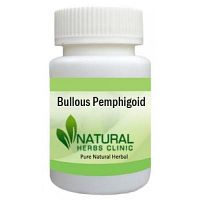 Natural Remedies for Bullous Pemphigoid