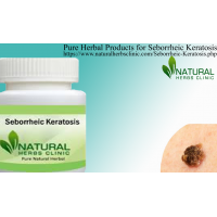 Natural Remedies for Seborrheic Keratosis