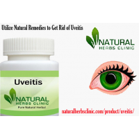Utilize Natural Remedies to Get Rid of Uveitis