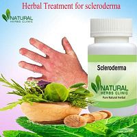Buy Herbal Product for Scleroderma Complete Treatment