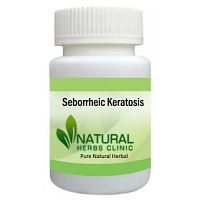 Totally Get Rid of Seborrheic Keratosis with Herbal Products