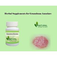 Herbal Supplements and Products for Granuloma Annulare