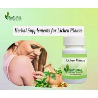 Herbal Products and Supplements for Lichen Planus Natural Recovery